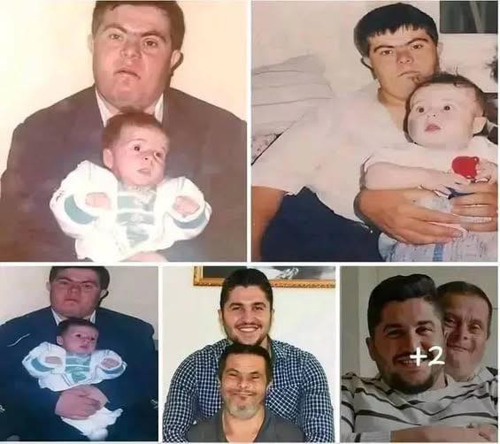 A father with Down syndrome raised his son, who is now a doctor...See more