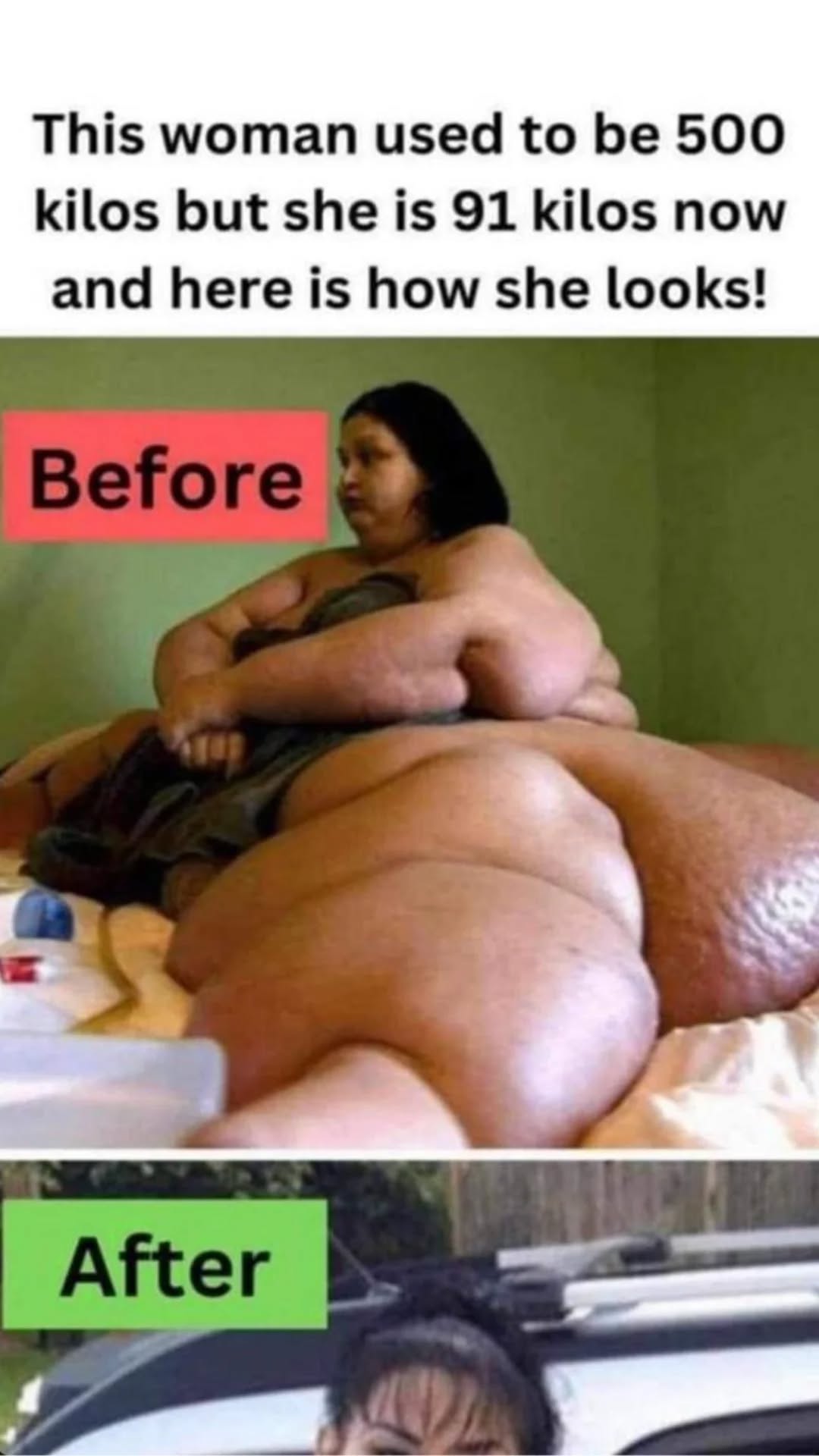 10 Of The Biggest Weight Loss Transformations Of All Time