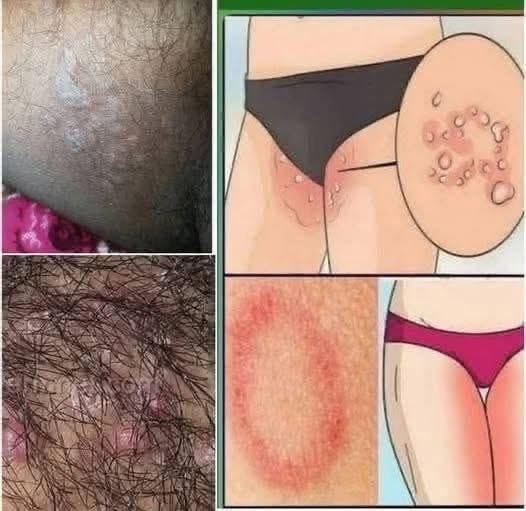 Inner Thigh Bumps: Causes, Prevention, and Safe Treatment Options